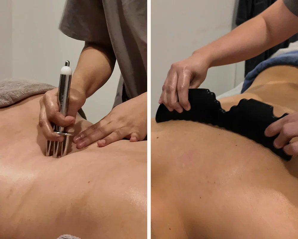 排酸疗法的三角磁叉与牛角拨筋的牛角刮板